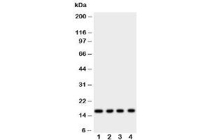 Western blot testing of Myoglobin antibody and rat samples 1: skeletal muscle (Myoglobin 抗体  (AA 138-154))