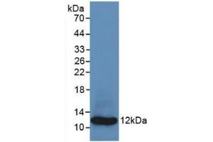 Detection of Recombinant S100A8, Human using Monoclonal Antibody to S100 Calcium Binding Protein A8 (S100A8) (S100A8 抗体  (AA 1-93))