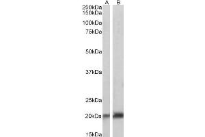 ABIN361198 (0. (Caveolin 3 抗体  (N-Term))