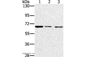 Western blot analysis of A172, hela and hepg2 cell, using IGF2BP3 Polyclonal Antibody at dilution of 1:200 (IGF2BP3 抗体)