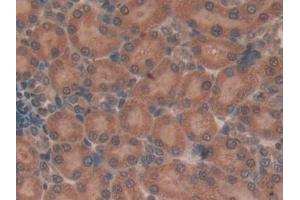 Detection of TUBd in Rat Kidney Tissue using Polyclonal Antibody to Tubulin Delta (TUBd) (TUBD1 抗体  (AA 238-482))