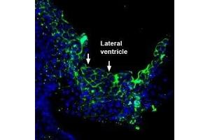Immunohistochemistry (IHC) image for anti-ATPase, Ca++ Transporting, Plasma Membrane 3 (ATP2B3) (AA 10-23), (Intracellular) antibody (ABIN7042957)