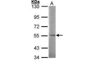 Image no. 1 for anti-N-Sulfoglucosamine Sulfohydrolase (SGSH) (AA 44-200) antibody (ABIN467364) (SGSH 抗体  (AA 44-200))