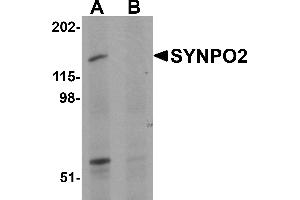 Western Blotting (WB) image for anti-Synaptopodin 2 (SYNPO2) (N-Term) antibody (ABIN1031593)