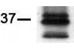 Western blot of PIM2 antibody (mAb). (PIM2 抗体)
