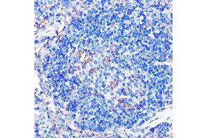 Immunohistochemistry of paraffin-embedded mouse spleen using CD86 Rabbit pAb (ABIN6131556, ABIN6138237, ABIN6138238 and ABIN6219508) at dilution of 1:100 (40x lens). (CD86 抗体  (AA 30-247))