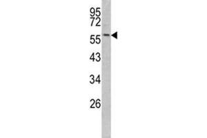 Western blot analysis of Keratin-14 antibody and mouse NIH3T3 lysate (KRT14 抗体  (AA 276-303))