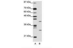 Image no. 1 for anti-ZFP36 Ring Finger Protein-Like 1 (ZFP36L1) (AA 46-95) antibody (ABIN202274) (ZFP36L1 抗体  (AA 46-95))