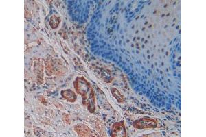 Used in DAB staining on fromalin fixed paraffin- embedded esophagus cancer tissue (SNCG 抗体  (AA 1-121))
