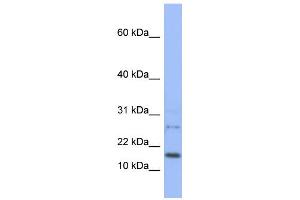 WB Suggested Anti-EDF1 Antibody Titration:  0. (EDF1 抗体  (N-Term))