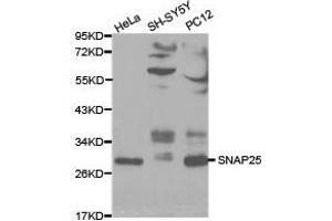 Western Blotting (WB) image for anti-Synaptosomal-Associated Protein, 25kDa (SNAP25) antibody (ABIN1874885) (SNAP25 抗体)