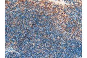 Detection of APOH in Mouse Spleen Tissue using Polyclonal Antibody to Apolipoprotein H (APOH) (APOH 抗体  (AA 21-345))