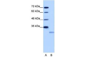 EIF4E2 antibody used at 2. (EIF4E2 抗体  (N-Term))