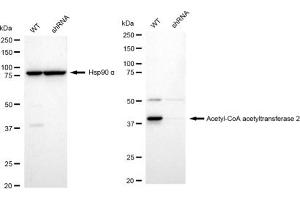 Western blotting analysis using Acetyl-CoA acetyltransferase 2 antibody (ABIN7797440).