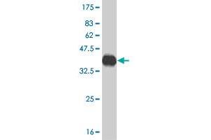 Western Blot detection against Immunogen (36. (CACNA1F 抗体  (AA 1878-1977))