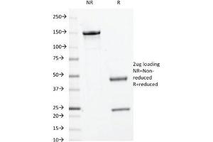 SDS-PAGE Analysis of Purified, BSA-Free c-Myc Antibody (clone 9E10. (c-MYC 抗体)