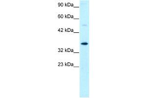 Western Blotting (WB) image for anti-General Transcription Factor IIH, Polypeptide 3, 34kD (GTF2H3) (N-Term) antibody (ABIN2777299)