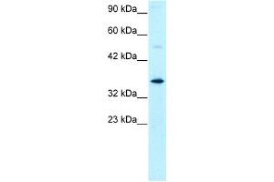 WB Suggested Anti-GTF2H3 Antibody Titration: 0. (GTF2H3 抗体  (N-Term))