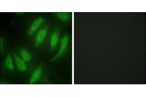 Immunofluorescence analysis of HeLa cells, using HES7 antibody. (HEXIM1 抗体)