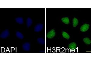 Immunofluorescence analysis of 293T cells using H3R2me1 antibody (ABIN3017476, ABIN3017477, ABIN3017478 and ABIN6220105). (Histone 3 抗体  (H3R2me))