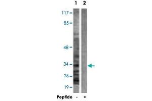 Western blot analysis of extracts from A-431 cells, using CASP6 polyclonal antibody .