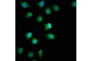 Immunofluorescence staining of A549 cells with ABIN7153110 at 1:100, counter-stained with DAPI. (FMN1 抗体  (AA 354-487))