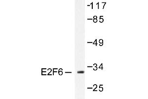Image no. 1 for anti-E2F Transcription Factor 6 (E2F6) antibody (ABIN265390) (E2F6 抗体)