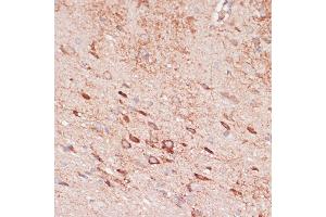 Immunohistochemistry of paraffin-embedded rat brain using OR10H3 antibody (ABIN7269086) at dilution of 1:100 (40x lens). (OR10H3 抗体  (AA 1-100))
