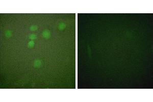 PMA + -Immunofluorescence analysis of HeLa cells, treated with PMA (125ng/ml, 30mins), using CREB (Ab-142) antibody (#B0006). (CREB1 抗体  (Ser142))
