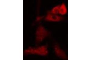 ABIN6274091 staining Hela cells by IF/ICC. (NDC80 抗体  (C-Term))