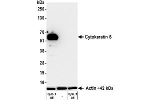 Western Blotting (WB) image for anti-Keratin 6 (KRT6) (C-Term) antibody (ABIN7795793) (Recombinant Keratin 6 抗体  (C-Term))