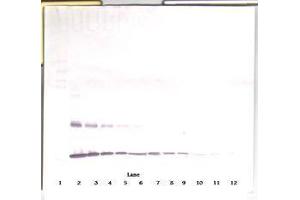 Image no. 5 for anti-Interleukin 1 alpha (IL1A) antibody (ABIN465571) (IL1A 抗体)