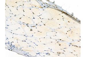 Phospho-Rab8 (Thr72) Antibody at 1/100 staining Rat skin tissue by IHC-P. (RAB8A 抗体  (pThr72))