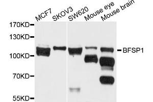 Western blot analysis of extracts of various cell lines, using BFSP1 antibody (ABIN5971950) at 1/1000 dilution. (Filensin 抗体)