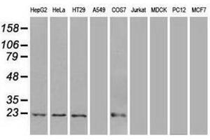 Image no. 2 for anti-Adenylate Kinase 1 (AK1) antibody (ABIN1496515) (Adenylate Kinase 1 抗体)