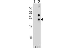 Western Blotting (WB) image for anti-Casein alpha S1 (CSN1S1) antibody (ABIN2997019) (Casein alpha S1 抗体)