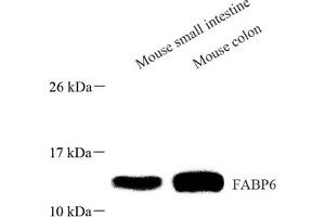 Western blot analysis of FABP6 (ABIN7073921) at dilution of 1: 1000 (FABP6 抗体)