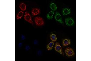 ABIN6258351 and ABIN6275664 staining HepG2 cells by IF/ICC. (UBE2D2 抗体  (C-Term))