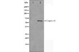 Western blot analysis on HeLa cell lysate using Caspase 10 Antibody,The lane on the left is treated with the antigen-specific peptide. (Caspase 10 抗体)
