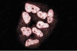 Immunofluorescence staining of HeLa cells (Human cervical epitheloid carcinoma, ATCC CCL-2. (TOPBP1 抗体  (AA 204-416))