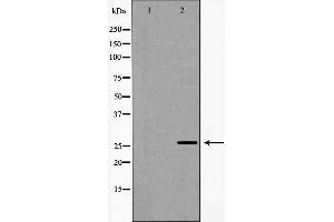Western blot analysis of extracts of HeLa , using NQO2 antibody. (NQO2 抗体  (N-Term))