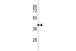 Western Blotting (WB) image for anti-Paired Box 6 (PAX6) (AA 352-380) antibody (ABIN3032127)
