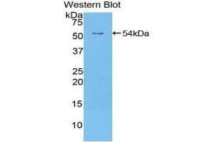 Western Blotting (WB) image for anti-Epidermal Growth Factor Receptor 2 (EGFR2) (AA 376-578) antibody (FITC) (ABIN1175126) (EGFR2 抗体  (AA 376-578) (FITC))