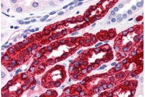 Human Kidney (formalin-fixed, paraffin-embedded) stained with UMOD antibody ABIN364281 at 20 ug/ml followed by biotinylated anti-mouse IgG secondary antibody ABIN481714, alkaline phosphatase-streptavidin and chromogen. (Uromodulin 抗体)
