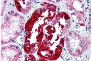 Human Kidney (formalin-fixed, paraffin-embedded) stained with ATG5 antibody ABIN296750 at 5 ug/ml followed by biotinylated goat anti-rabbit IgG secondary antibody ABIN481713, alkaline phosphatase-streptavidin and chromogen. (ATG5 抗体  (AA 1-50))