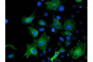 Anti-ARFGAP1 mouse monoclonal antibody (ABIN2454308) immunofluorescent staining of COS7 cells transiently transfected by pCMV6-ENTRY ARFGAP1 (RC206987). (ARFGAP1 抗体)