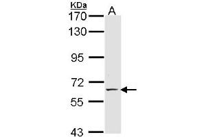Western Blotting (WB) image for anti-Selectin E (SELE) (AA 278-506) antibody (ABIN467628) (Selectin E/CD62e 抗体  (AA 278-506))