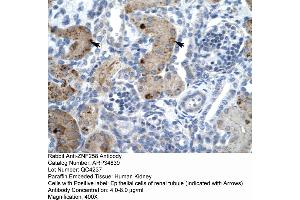 Immunohistochemistry (IHC) image for anti-Zinc Finger, MYM-Type 6 (ZMYM6) (Middle Region) antibody (ABIN2776049)