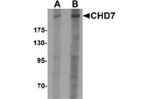 Western blot analysis of CHD7 in SK-N-SH cell lysate with CHD7 antibody at (A) 1 and (B) 2 ug/mL.