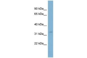 WB Suggested Anti-SLC25A20  Antibody Titration: 0. (SLC25A20 抗体  (Middle Region))
